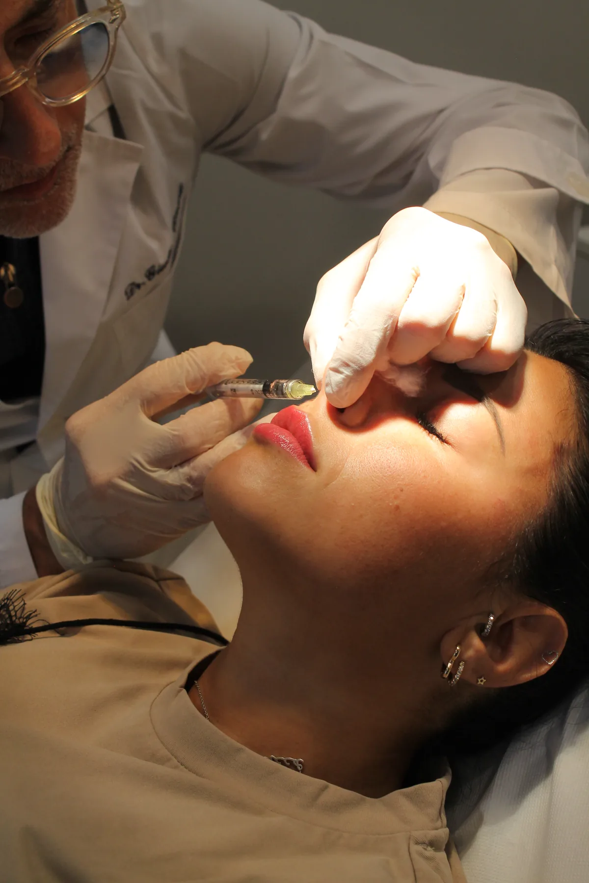 Dettaglio tecnico di trattamento filler durante una sessione ADF